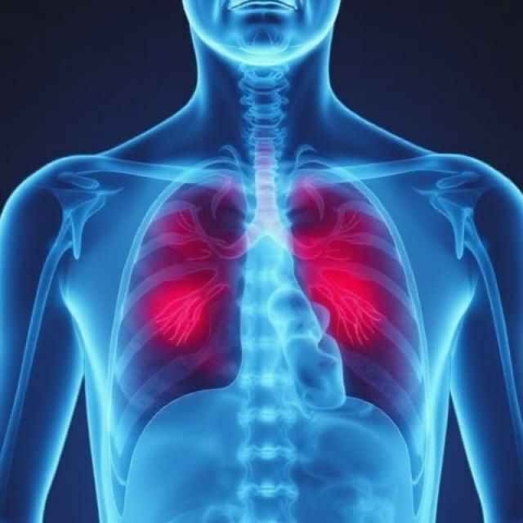 نشانه‌ها و علائم بیماری سل چیه؟